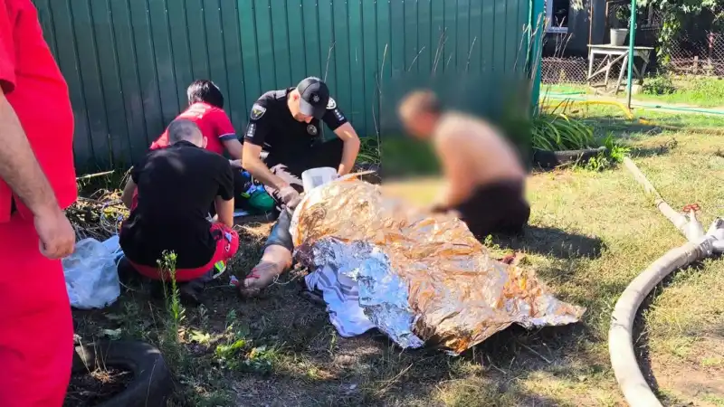 Пожежа у селі Микільське забрала життя жінки, її чоловік у лікарні